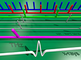 KIT-IBPT researchers show the potential of tuning the emitted frequency comb at accelerator based light-sources at ANKA which enables new ultra-high resolution spectroscopy and metrology applications from the terahertz to the X-ray region.